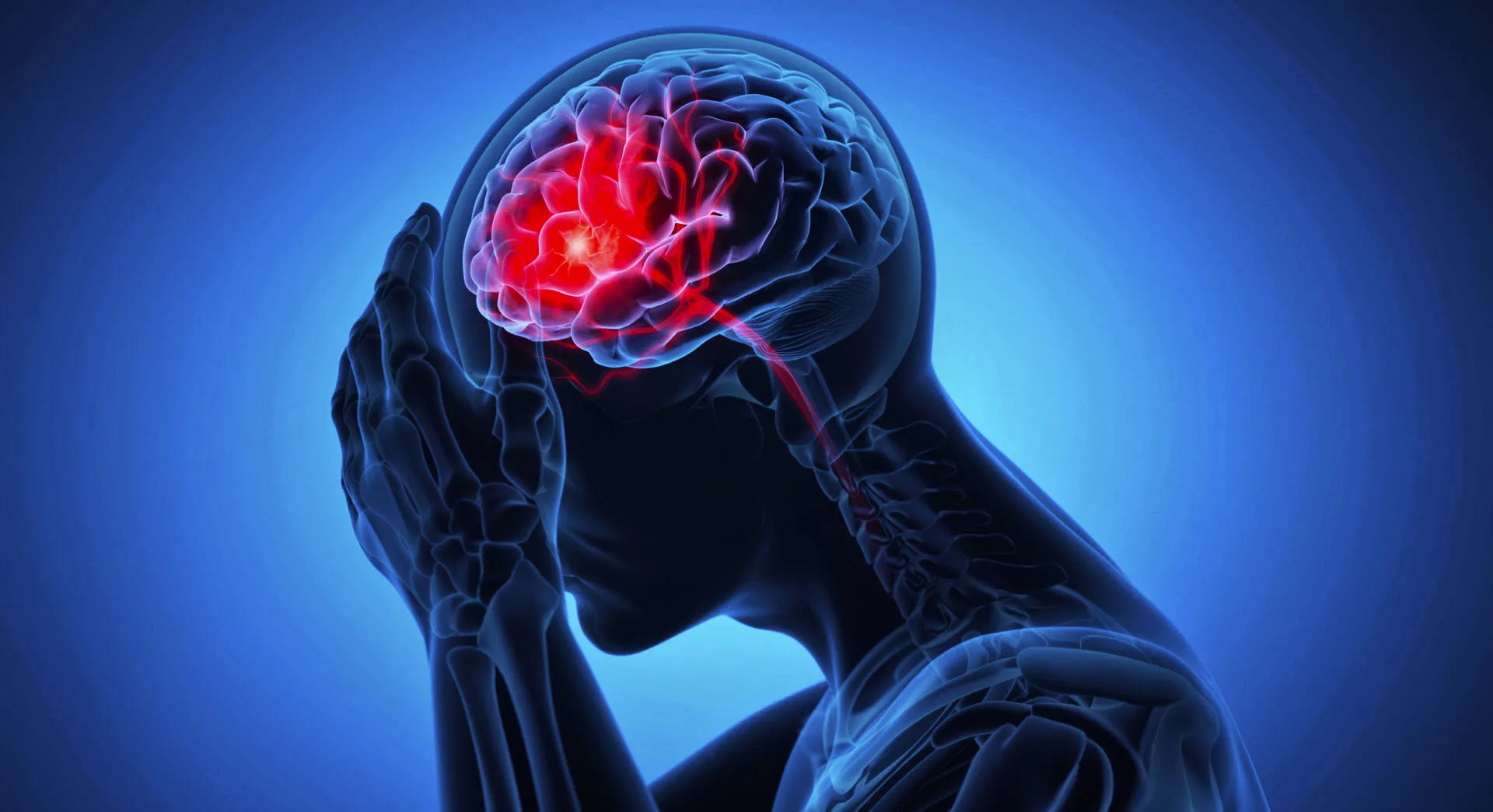 02 ilustrasi brain rot